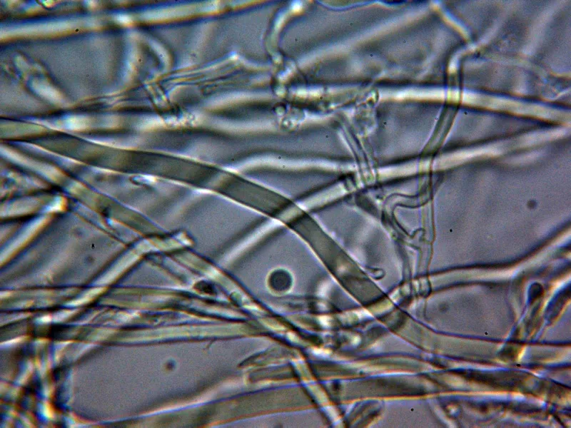 Antrodia macra 10 - Hifas KOH